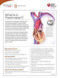 What is a pacemaker Answers by Heart sheet