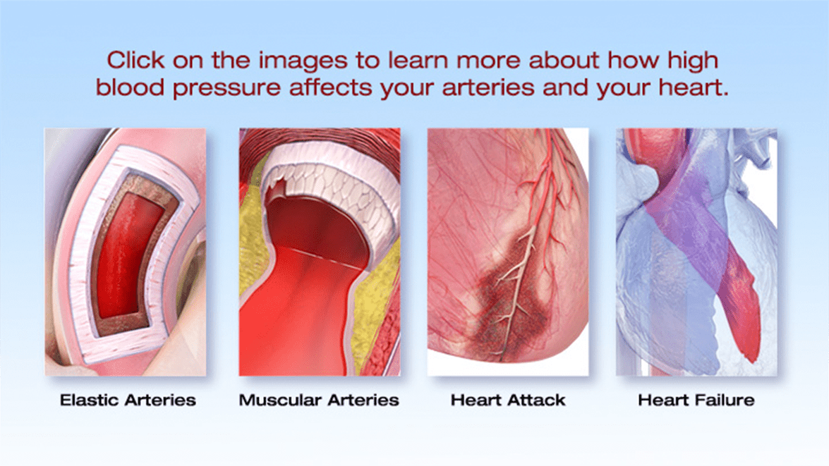 See how HBP damages heart