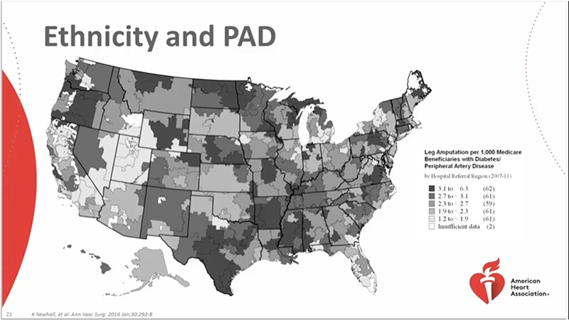 Treating PAD in Underserved Communities
