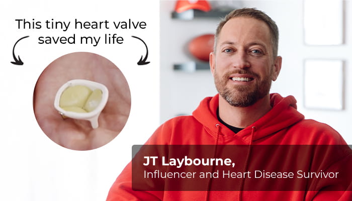 JT Laybourne and the artificial heart valve that saved his life